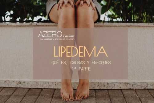 Lipedema: qué es, causas y enfoques (1ª parte)