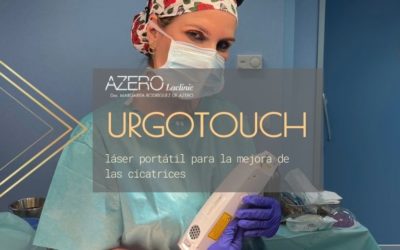 UrgoTouch, láser portátil para la mejora de las cicatrices